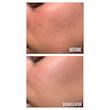 سرم ضد لک و شفاف کننده دارک اسپات اکسیس وای AXIS-Y Axis-Y Dark Spot Correcting Glow Serum