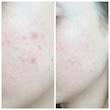 کرم ترمیم کننده لاروش پوزای Cicaplast  LA ROCHE-POSAY CICAPLAST BAUME B5