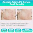 سرم آزلائیک اسید مدیکیوب 16 درصد Medicube Azelaic Acid BB Calming Serum