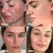 سرم پیلینگ سوکسینیک اسید مدیکیوب Medicube Red Acne Succinic Acid Peel
