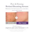 سرم رتینول و NMN مدیکیوب Medicube Retinol NMN Boosting Serum