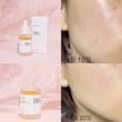  آمپول تسکین دهنده و مرطوب کننده هارتلیف آنوا Anua Heartleaf 80% Moisture Soothing Ampoule 