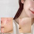  آمپول تسکین دهنده و مرطوب کننده هارتلیف آنوا Anua Heartleaf 80% Moisture Soothing Ampoule 