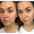 تونر آبرسان و تسکین دهنده سنتلا کوزارکس فاقد الکل Cosrx Centella Water Alcohol-Free Toner