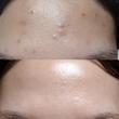  تونر لایه بردار درمانی، آبرسان و روشن کننده AHA و BHA کوزارکس Cosrx AHA/BHA clarifying treatment toner