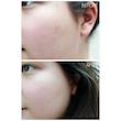  تونر لایه بردار درمانی، آبرسان و روشن کننده AHA و BHA کوزارکس Cosrx AHA/BHA clarifying treatment toner