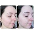  اسنس متعادل کننده رنگ پوست گالاکتومایسس کوزارکس COSRX GALACTOMYCES 95 TONE BALANCING ESSENCE