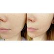 کرم هیالورونیک اسید آبرسان کوزارکس cosrx hyaluronic acid intensive cream