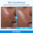 سرم کنترل منافذ بایو رتینول آبی و نیاسینامید شماره 3 نامبوزین Numbuzin No.3 Blue Bio-Retinol Pore Refining Ampoule 