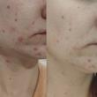  تونر روشن کننده و ضد لک یوجا نیاسین سام بای می Some By Mi Yuja Niacin Miracle Brightening Toner