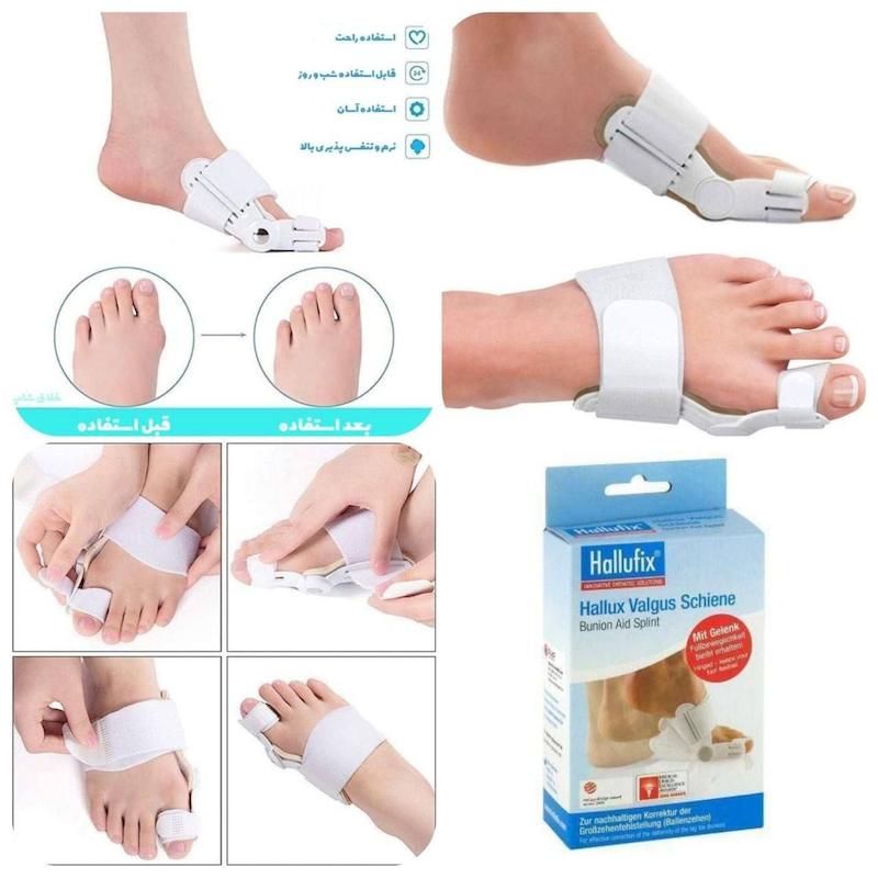  اصلاح‌کننده انحراف شست پا هالوفیکس Hallufix