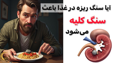 سنگ‌ریزه در غذا و ارتباط آن با سنگ کلیه: افسانه یا واقعیت؟