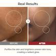 تونر پیل شات برنج لایه بردار و روشن کننده پوست دکتر ملاکسین drmelaxintoner peel shot 