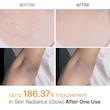 اسپری پیل شات کوجیک اسید لایه بردار و روشن کننده بدن دکتر ملاکسینdr melaxin peelshot