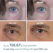 کرم دور چشم ضد پف و تیرگی دکتر ملاکسین مدل Eyephalt
