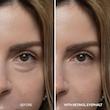 کرم دور چشم رتینول دکتر ملاکسین dr melaxin eyecream eyephalt retinol