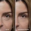 کرم دور چشم رتینول دکتر ملاکسین dr melaxin eyecream eyephalt retinol