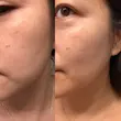 سرم ضد لک و روشن‌کننده نیاسینامید و ترانگزامیک اسید آنوا serum txa niacinamid anua