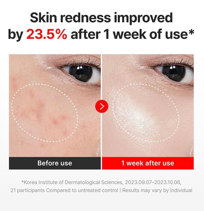 مادکا کرم ضد چروک، تسکین دهنده، ترمیم کننده و جوانساز سنتلین 24 – CENTELLIAN 24 Madeca Cream