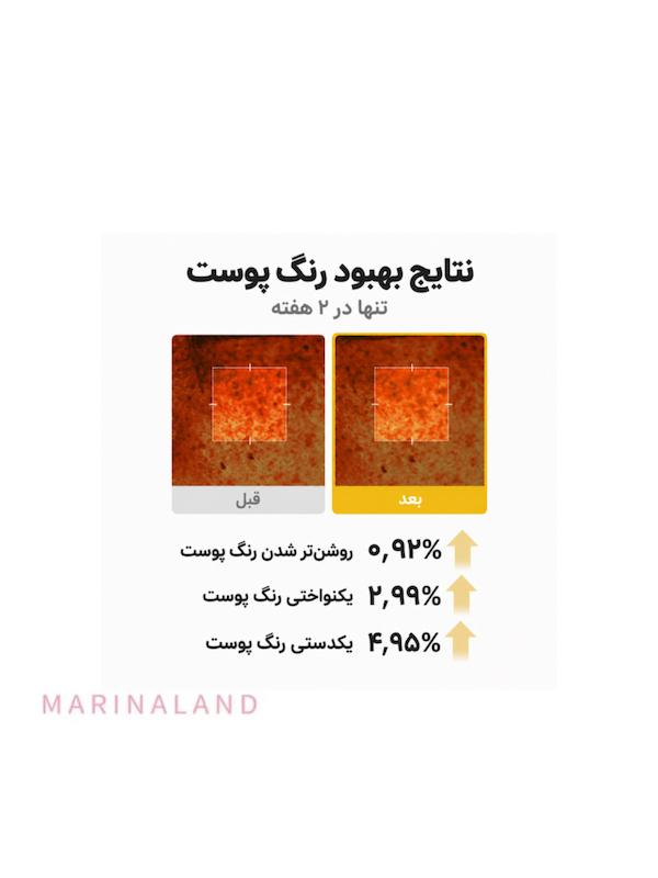 کرم کپسولی روشن کننده اسید کوجیک مدیکیوب مدل Kojic Acid Turmeric Vita Capsule Cream