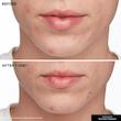 محلول موضعی ضدجوش و کاهش التهاب کیت سامرویل انگلیس Kate Somerville EradiKate Blemish Spot Treatment 30ml 