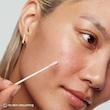 محلول موضعی ضدجوش و کاهش التهاب کیت سامرویل انگلیس Kate Somerville EradiKate Blemish Spot Treatment 30ml 