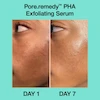 سرم درمان کننده منافذ دکتر جارت Dr.Jart+ Pore Remedy PHA Exfoliating Serum