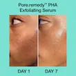 سرم درمان کننده منافذ دکتر جارت Dr.Jart+ Pore Remedy PHA Exfoliating Serum
