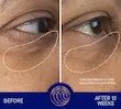 کرم دور چشم لوکس قوی جوانساز آگوستینوس بادر‌ اصل از انگلیس AUGUSTINUS BADER The Eye Cream Nomad