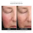 تونر لایه بردار مندلیک اسید و لاکتیک اسید پائولاز چویس اورجینال آمریکا  Paula’s Choice 6% mandelic acid + 2% lactic acid liquid exfoliant