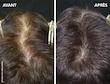 مکمل ضد ریزش و تقویت کننده مو فیتوسیان اورجینال آمریکا Phyto Phytocyane Hair Loss Food Supplement Capsules