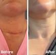 کرم ترمیم‌ کننده اون سیکالفیت اورجینال از ایتالیا Avene‌ Cicalfate+ Restorative Protective Cream