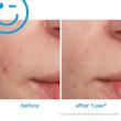 محلول موضعی ضدجوش و کاهش التهاب کیت سامرویل انگلیس Kate Somerville EradiKate Blemish Spot Treatment 30ml 