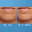 محلول موضعی ضدجوش و کاهش التهاب کیت سامرویل انگلیس Kate Somerville EradiKate Blemish Spot Treatment 30ml 