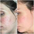 کرم ترمیم‌ کننده اون سیکالفیت اورجینال از ایتالیا Avene‌ Cicalfate+ Restorative Protective Cream