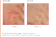 کرم ترمیم‌ کننده اون سیکالفیت اورجینال از ایتالیا Avene‌ Cicalfate+ Restorative Protective Cream