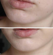 سرم مولتی پپتاید بافه اوردینری ضدچروک و جوانساز پوست اوردینری اصل آمریکا  (The Ordinary Multi-Peptide + HA Serum (buffet