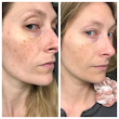 سرم مولتی پپتاید بافه اوردینری ضدچروک و جوانساز پوست اوردینری اصل آمریکا  (The Ordinary Multi-Peptide + HA Serum (buffet