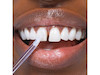 برق لبخند و سفیدکننده فوری دندان  های اسمایل اصل از انگلیس  Hismile Glossteeq Tooth Gloss | 4ml