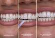 برق لبخند و سفیدکننده فوری دندان  های اسمایل اصل از انگلیس  Hismile Glossteeq Tooth Gloss | 4ml