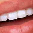 برق لبخند و سفیدکننده فوری دندان  های اسمایل اصل از انگلیس  Hismile Glossteeq Tooth Gloss | 4ml