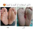 کرم چند کاره ترک پا