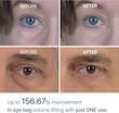 کرم دور چشم درمان پف و تیرگی دکتر ملاکسین Dr.Melaxin Eyephalt Eyebag Cream