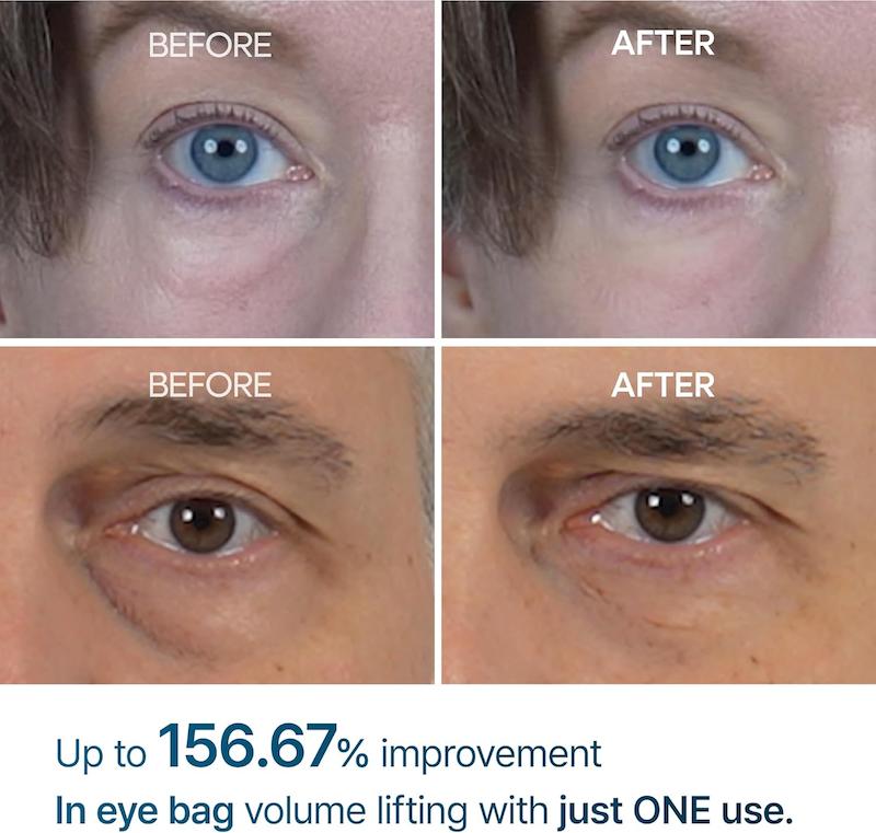 کرم دور چشم درمان پف و تیرگی دکتر ملاکسین Dr.Melaxin Eyephalt Eyebag Cream