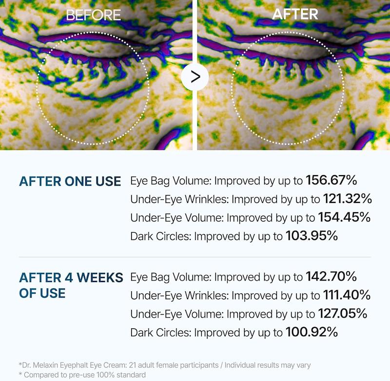 کرم دور چشم درمان پف و تیرگی دکتر ملاکسین Dr.Melaxin Eyephalt Eyebag Cream