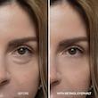 کرم دور چشم رتینول و کلاژن ایفالت دکتر ملاکسین | Dr.Melaxin Retinol & Collagen Eye Cream