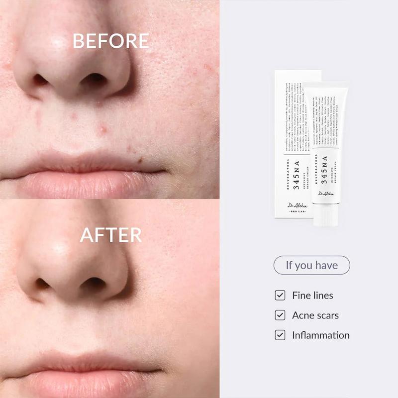 کرم ترمیم‌کننده دکتر آلتیا مدل 345 حجم 50 میلی‌لیتر (Dr.Althea 345 Relief Cream)