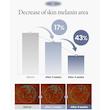کرم ضدلک و روشن کننده TXA 2.5% اکسیس‌وای (AXIS-Y TXA 2.5% Intensive Brightening Cream)