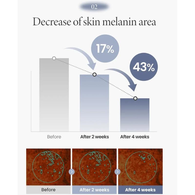 کرم ضدلک و روشن کننده TXA 2.5% اکسیس‌وای (AXIS-Y TXA 2.5% Intensive Brightening Cream)