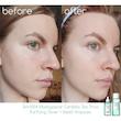 آمپول ماداگاسکار سنتلا چای سبز تی تریکا Skin 1400 تسکین دهنده و ضد جوش حجم 100میل